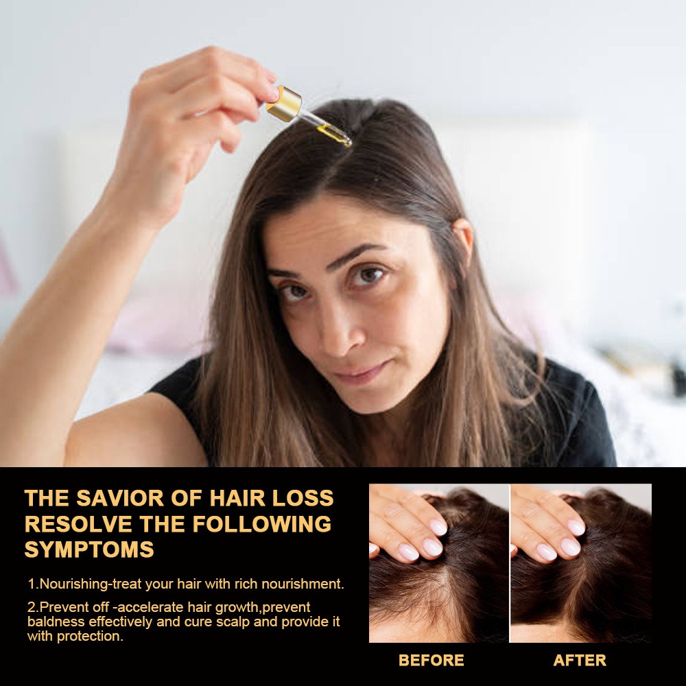 Sumifun Anti-Hair Loss Serum Polygonum Multiflorum Hair Repair Improve Hair Growth - Image 2