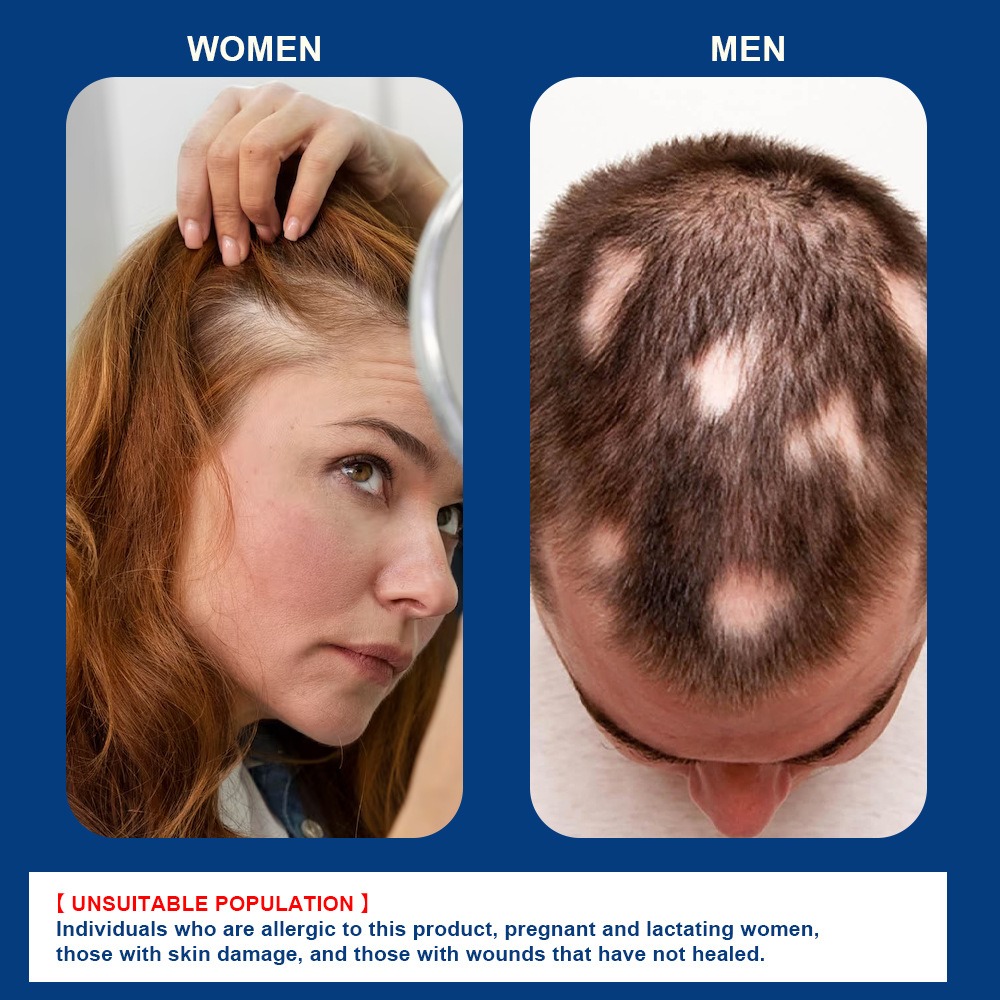 Sumifun Hair Growing Cream Prevents Alopecia and Baldness Repair Damage Hairs - Image 2