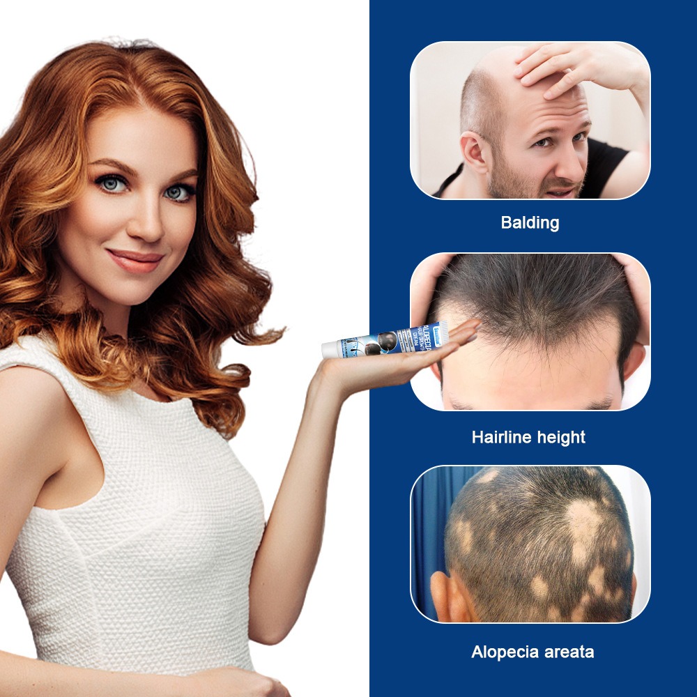 Sumifun Hair Growing Cream Prevents Alopecia and Baldness Repair Damage Hairs - Image 3