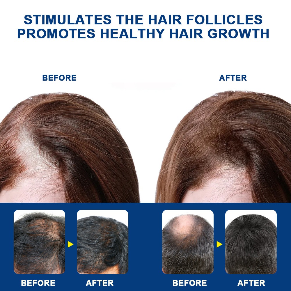 Sumifun Hair Growing Cream Prevents Alopecia and Baldness Repair Damage Hairs - Image 4