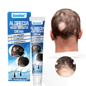Sumifun Hair Growing Cream Prevents Alopecia and Baldness Repair Damage Hairs