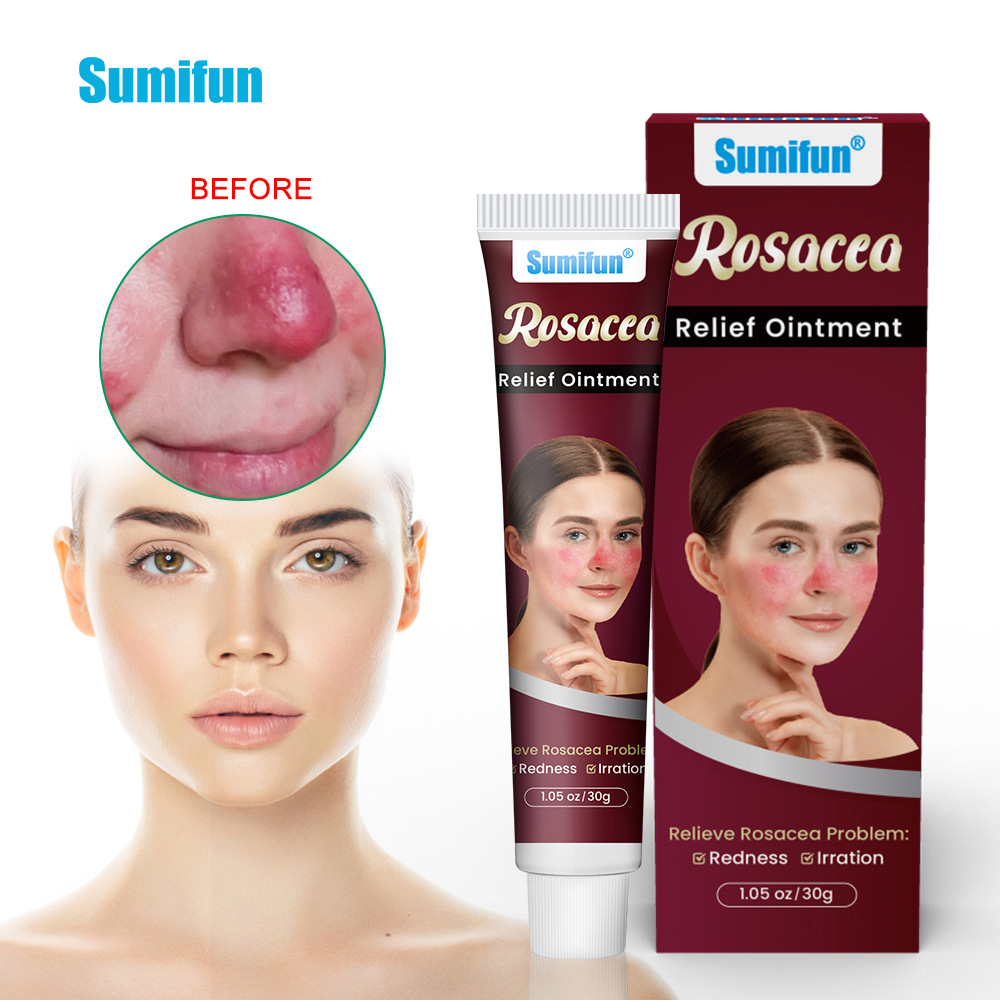Sumifun Redness Relief Face Cream 30g | Soothing Facial Moisturizing Cream | Daily Skin Care Cream for Sensitive Skin