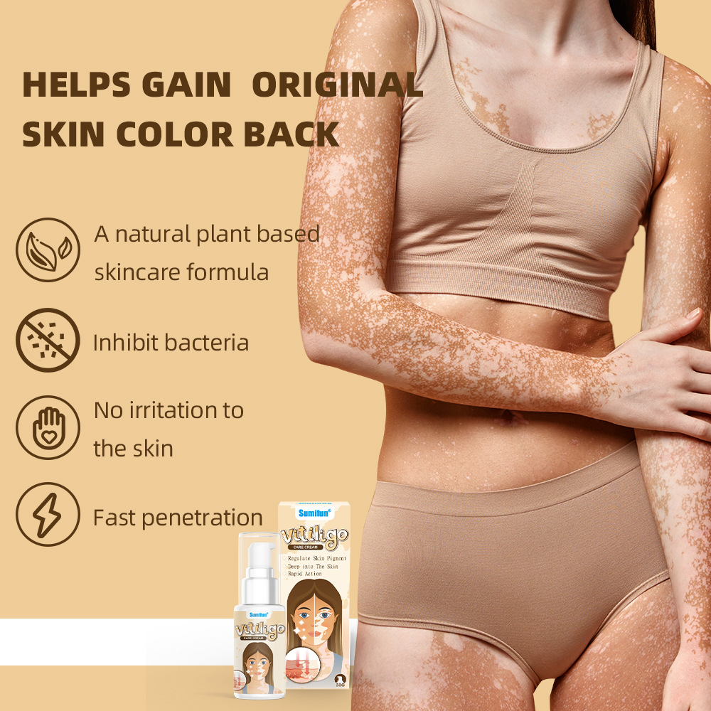 Sumifun Vitiligo Care Cream 30ml | Pigmentation Care Cream | Botanical Skin Care Formula | Daily Skin Care | External Use - Image 3