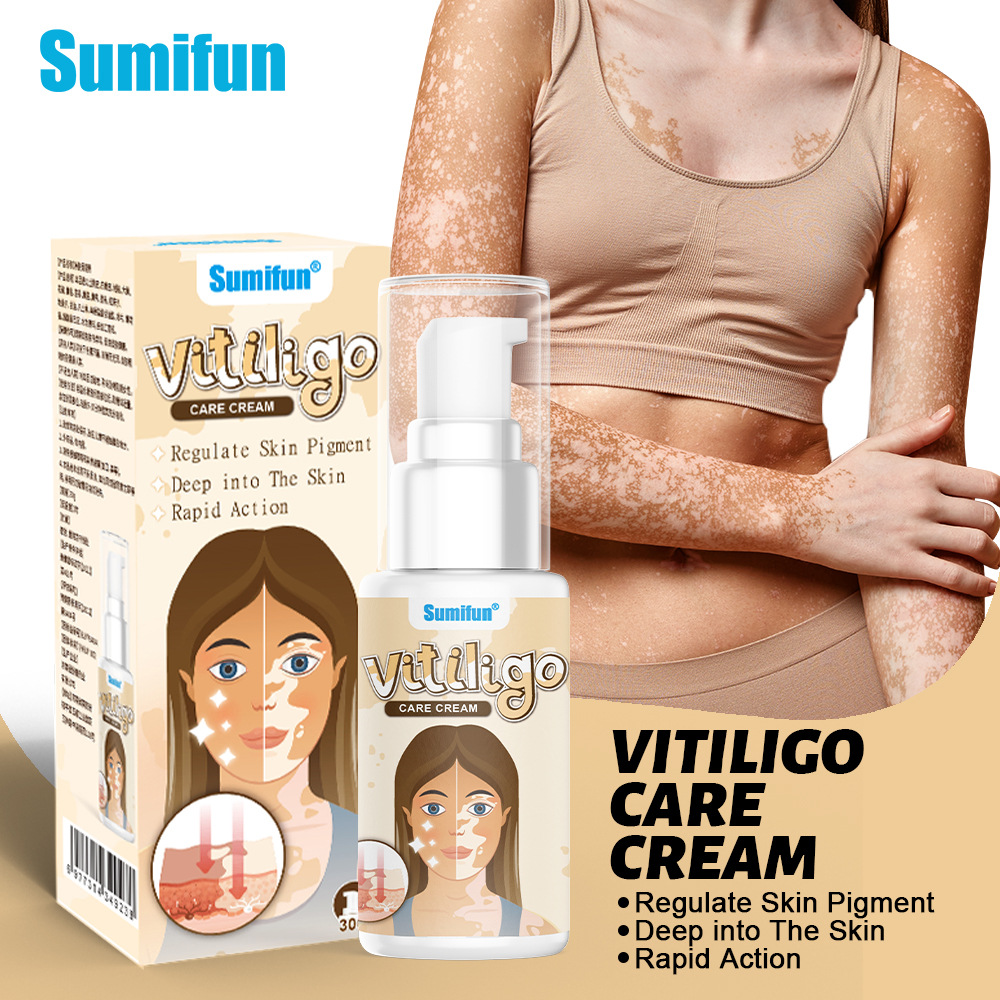 Sumifun Vitiligo Care Cream 30ml | Pigmentation Care Cream | Botanical Skin Care Formula | Daily Skin Care | External Use