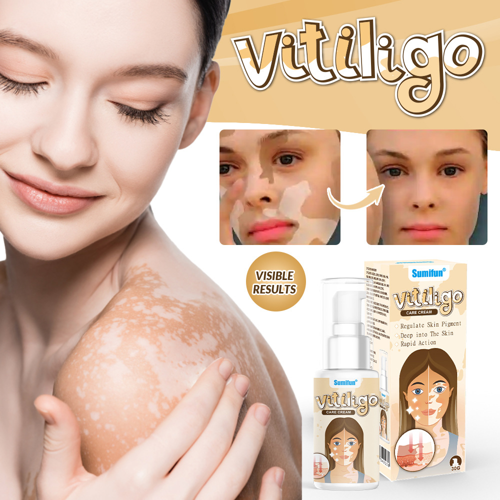 Sumifun Vitiligo Care Cream 30ml | Pigmentation Care Cream | Botanical Skin Care Formula | Daily Skin Care | External Use - Image 5