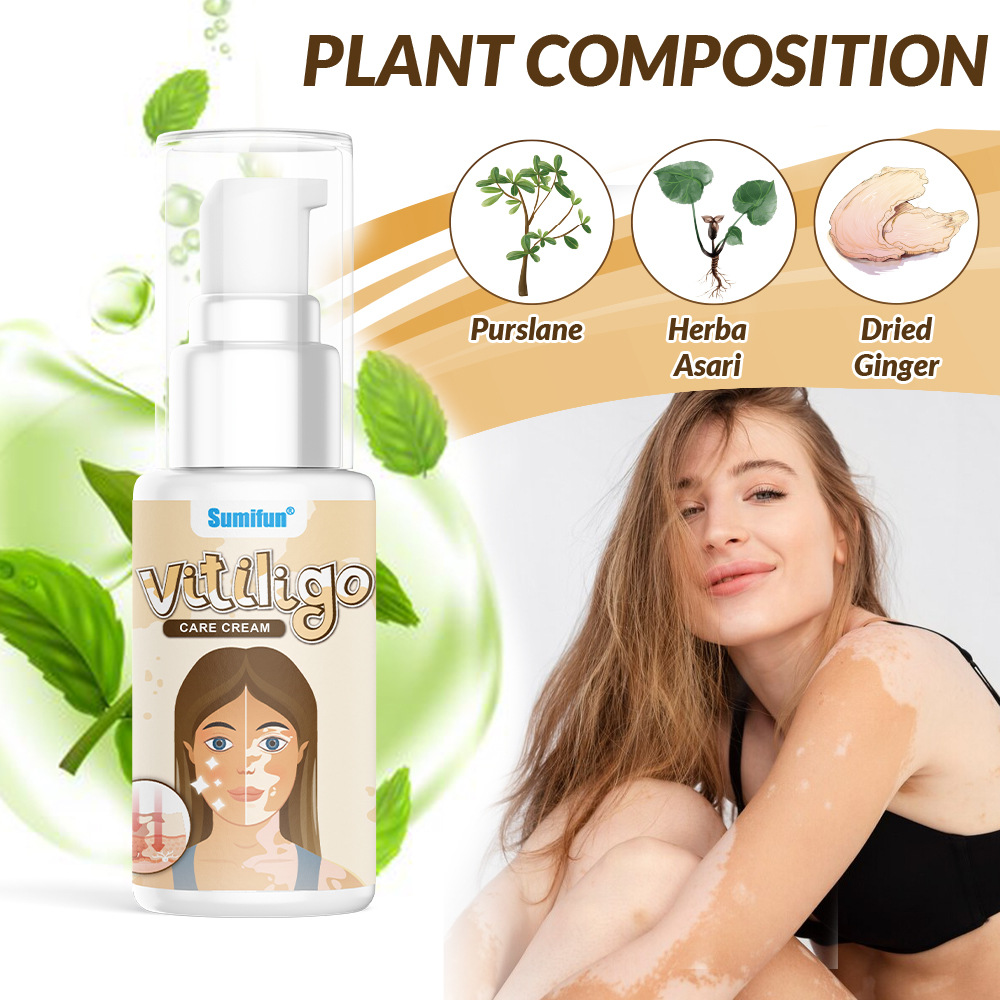 Sumifun Vitiligo Care Cream 30ml | Pigmentation Care Cream | Botanical Skin Care Formula | Daily Skin Care | External Use - Image 6